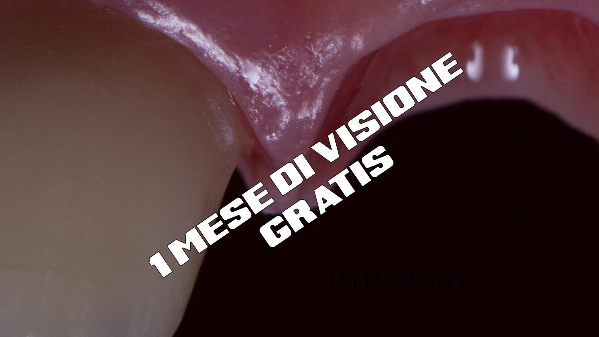 GESTIONE CHIRURGICA DEI TESSUTI MOLLI IN PARODONTOLOGIA E IMPLANTOLOGIA – PROMO 1 MESE