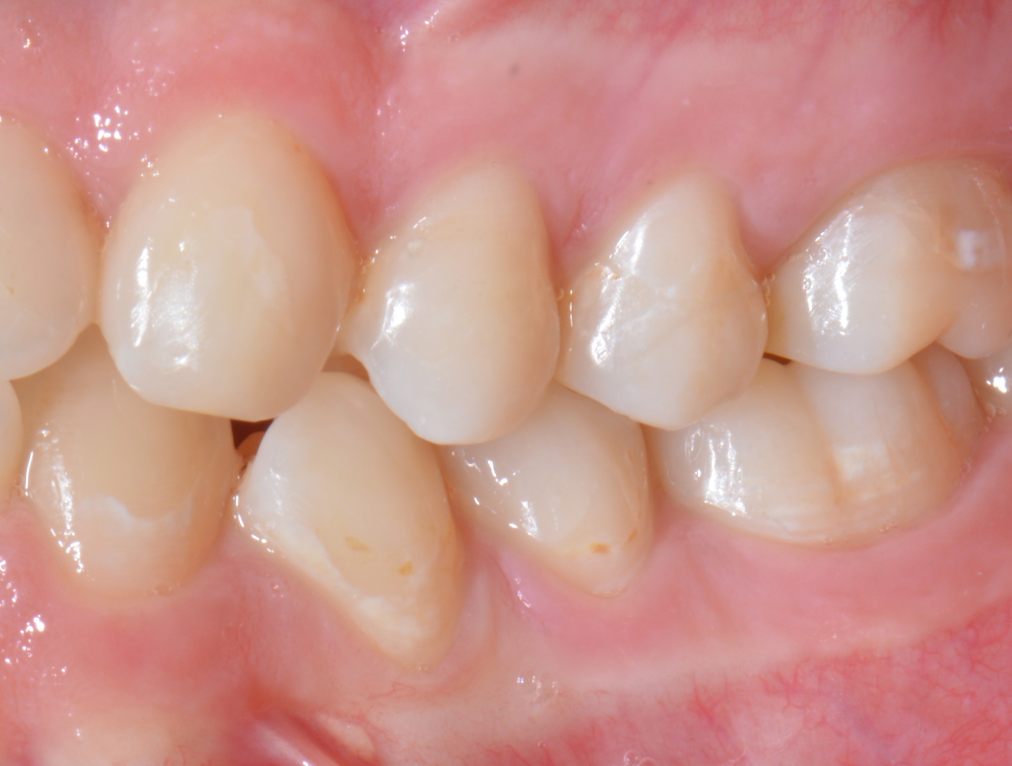 Sacra tecnica della doppia matrice 4