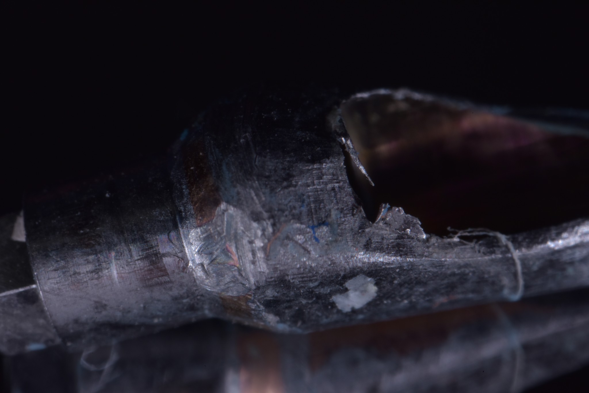 gestione dei tessuti molli - moncone ruvido 1