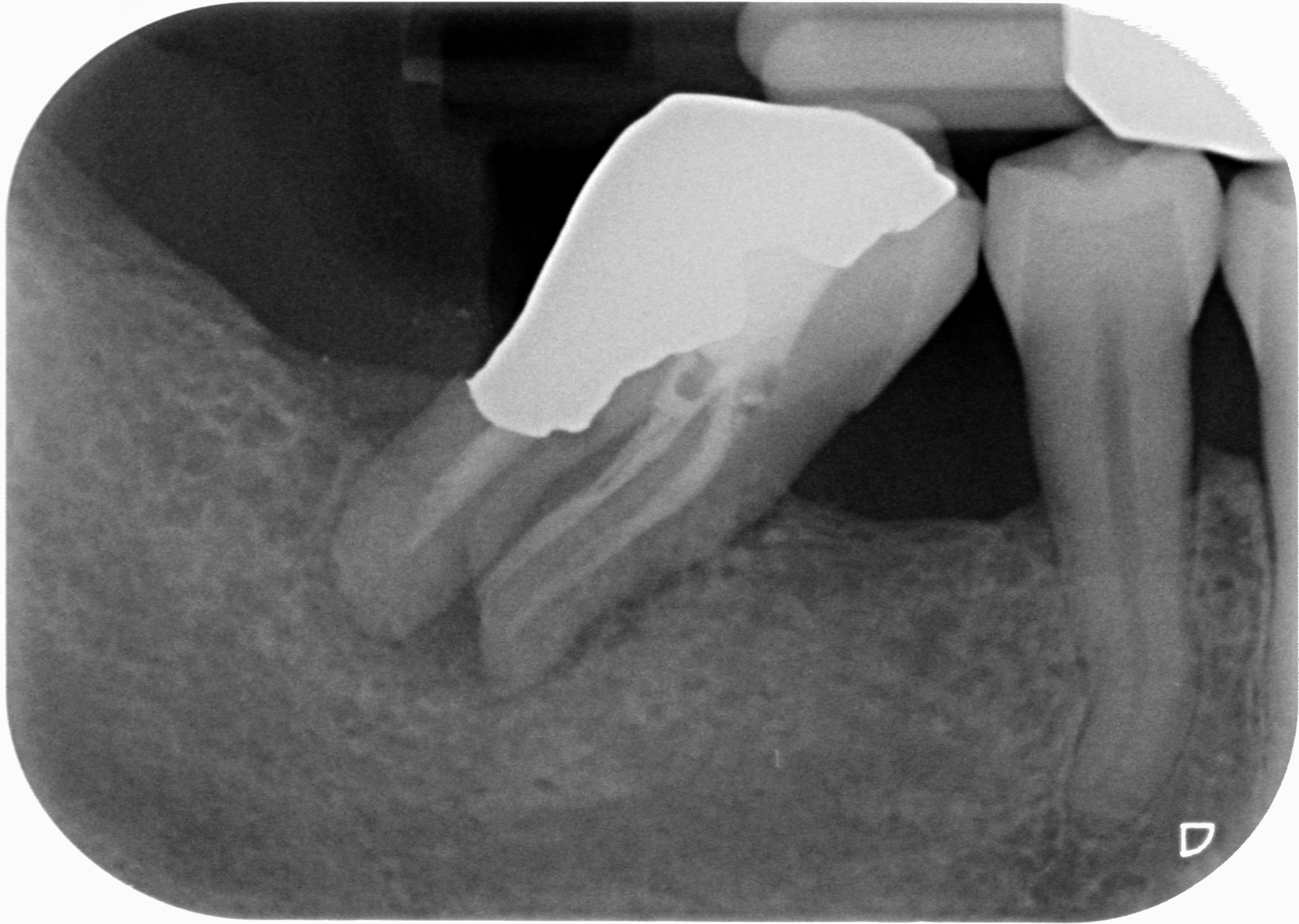 Sacra tecnica della doppia matrice 7