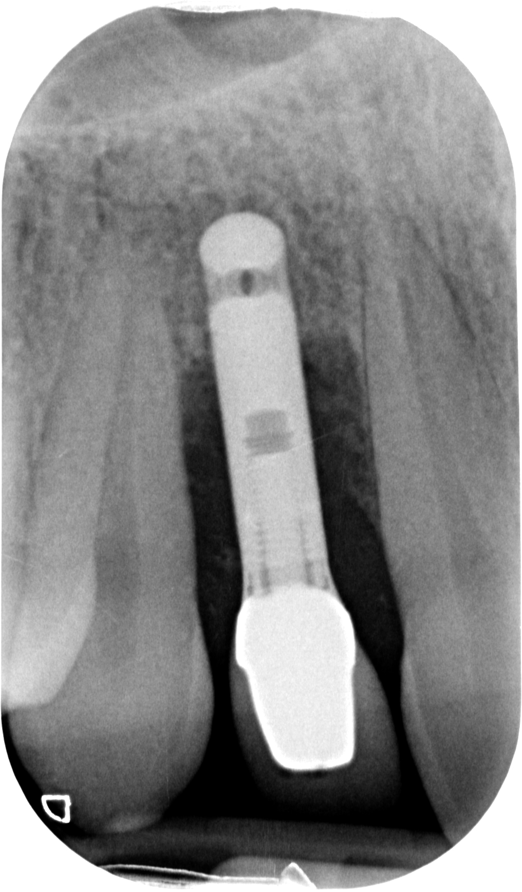 Sconosciuto-X-20151123-200312-XYHMH6ZQBS2X-4