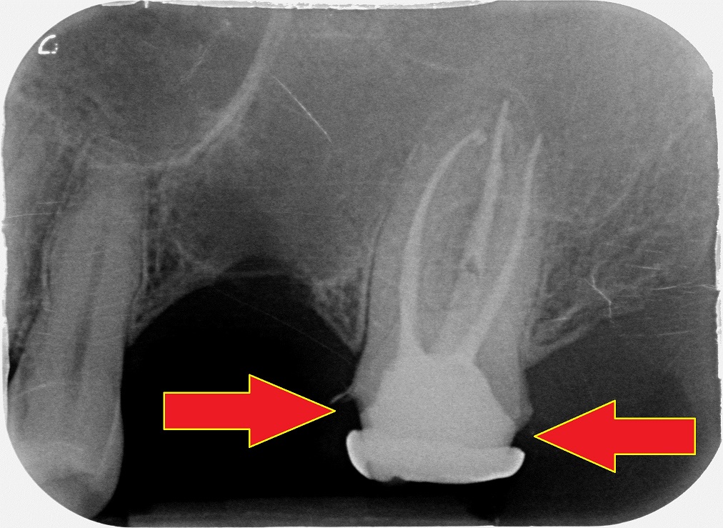 Sconosciuto-X-20160331-172455-XS421RDZJC8L-4 CON FRECCE