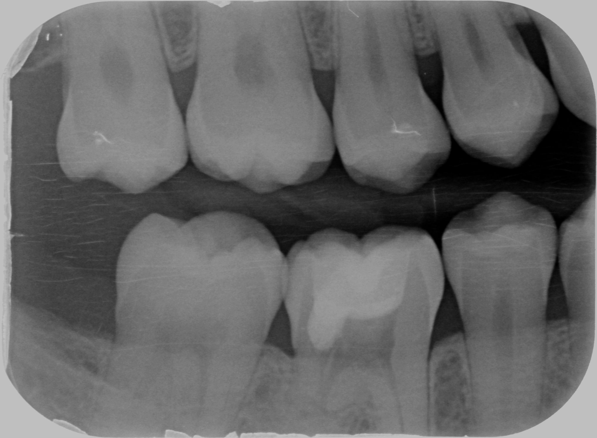 Sconosciuto-X-20160414-124407-XI+0ZQJHPJ47-4