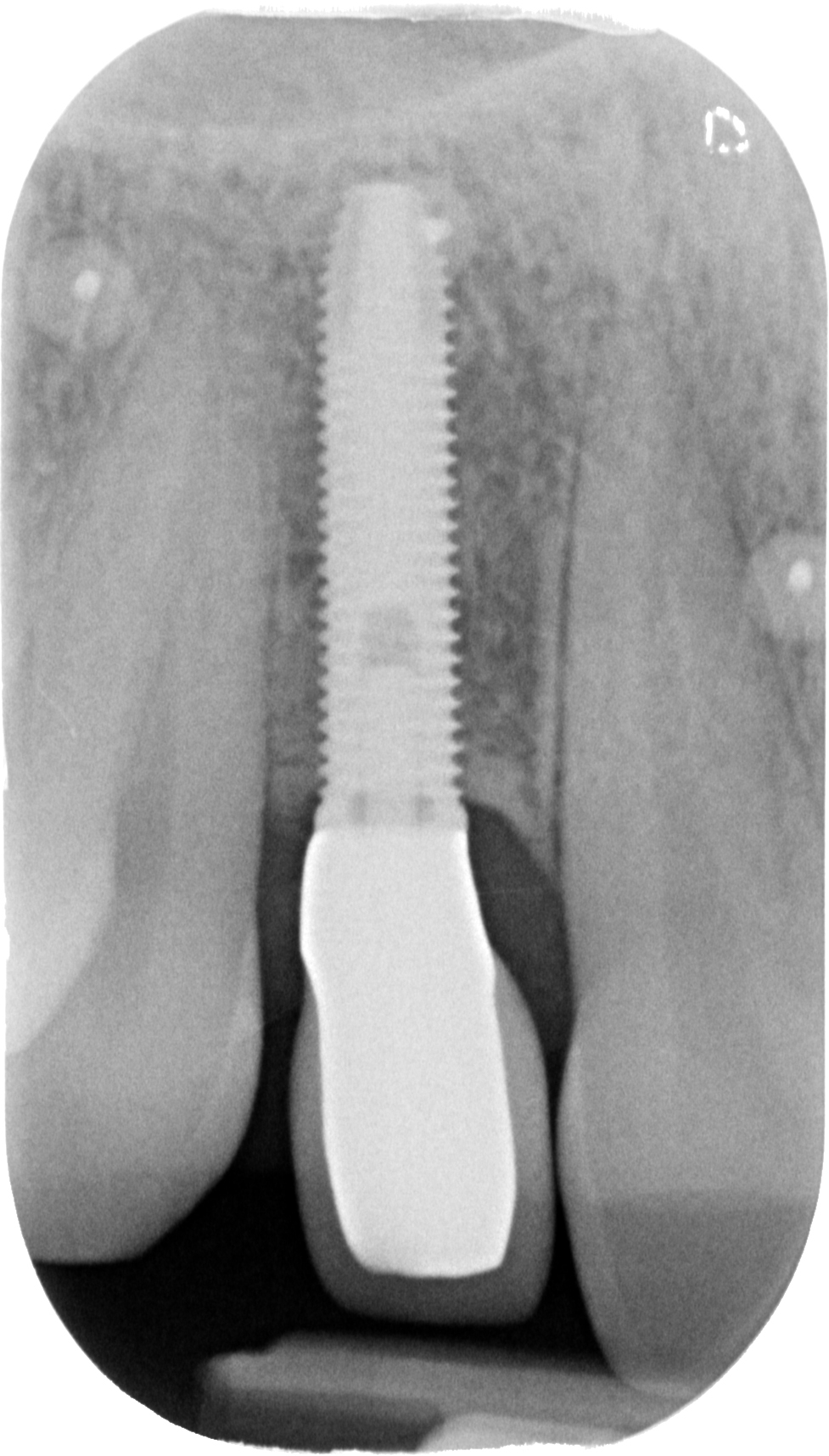 Sconosciuto-X-20170116-083502-XORTARNGADP-4