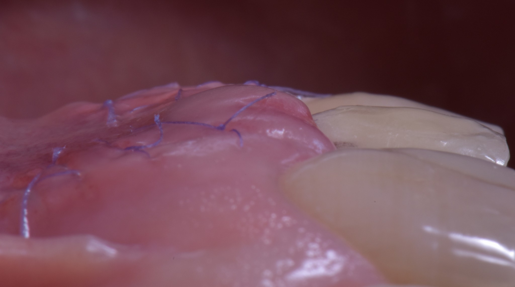 corso gestione dei tessuti molli - guarigione 2