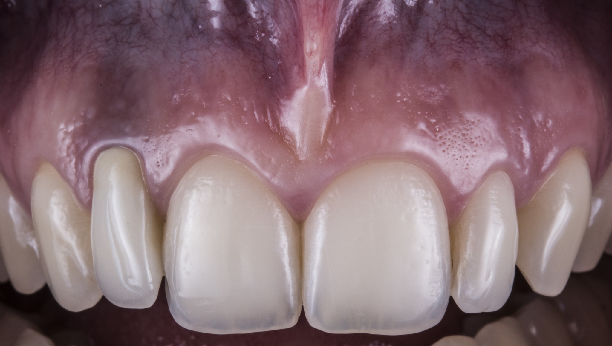 immagine di copertina + testo